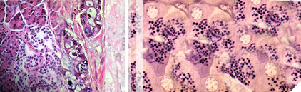 thyroid-diagnostics-banner